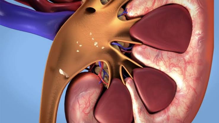 Tinubu Reduces Dialysis Cost in Federal Hospitals to ₦12,000